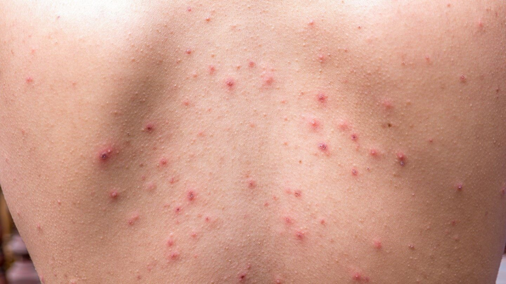 Common Skin Issues and Solutions: